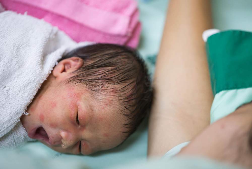 How Common Are Birth Injuries?