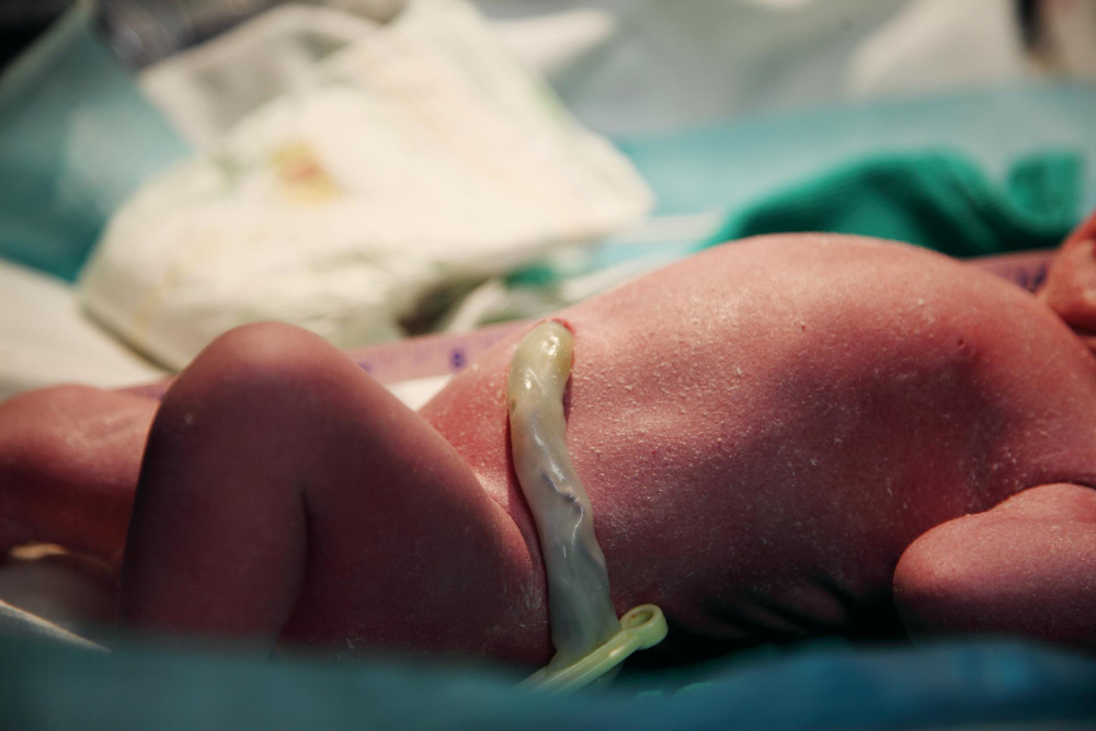 Could My Birth Injury Have Been Prevented?